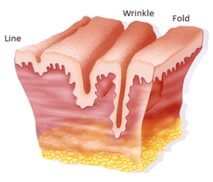 Facial creases and wrinkles