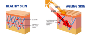 Healthy Skin vs Aging Skin