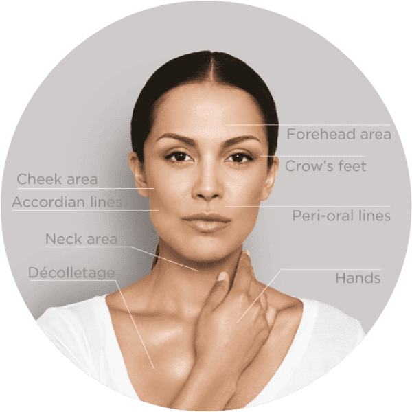 Restylane Skin Boosters – Skinrhümmd