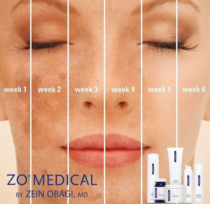 ZO Skin Health