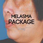 Melasma Package