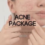 Acne Package - Moderate/Severe Acne