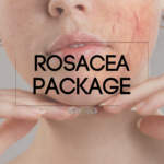 Rosacea Package