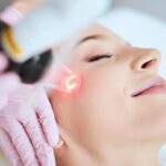 Laser Resurfacing
