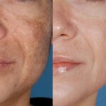 Control Depth Peel